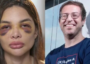 Dentista faz novas acusações contra empresário no ‘Fantástico’ e aponta violência sexual e tentativas de divórcio: “Eu acordava com ele em cima de mim”; assista Dentista faz novas acusações contra empresário no ‘Fantástico’ e aponta violência sexual e tentativas de divórcio: “Eu acordava com ele em cima de mim”; assista