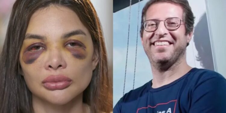 Dentista faz novas acusações contra empresário no ‘Fantástico’ e aponta violência sexual e tentativas de divórcio: “Eu acordava com ele em cima de mim”; assista Dentista faz novas acusações contra empresário no ‘Fantástico’ e aponta violência sexual e tentativas de divórcio: “Eu acordava com ele em cima de mim”; assista