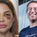 Dentista faz novas acusações contra empresário no ‘Fantástico’ e aponta violência sexual e tentativas de divórcio: “Eu acordava com ele em cima de mim”; assista Dentista faz novas acusações contra empresário no ‘Fantástico’ e aponta violência sexual e tentativas de divórcio: “Eu acordava com ele em cima de mim”; assista