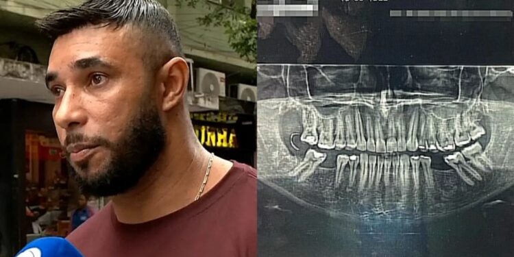 Homem extrai siso e se revolta com descoberta após passar 10 dias sem comer e beber no RJ Foto: Reprodução/Record