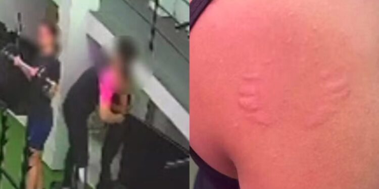 Instrutor que mordeu professora em academia no Recife se manifesta: ‘Atitude lúdica’ Instrutor que mordeu professora em academia no Recife se manifesta: ‘Atitude lúdica’