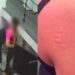 Instrutor que mordeu professora em academia no Recife se manifesta: ‘Atitude lúdica’ Instrutor que mordeu professora em academia no Recife se manifesta: ‘Atitude lúdica’
