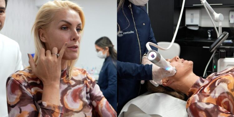 Ana Hickmann faz procedimento estético antes de casamento com Edu Guedes