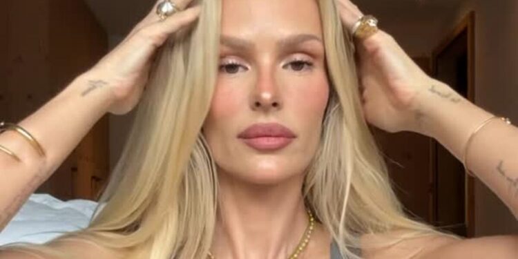 Yasmin Brunet exibe marcas do lipedema e relata dor e queimação